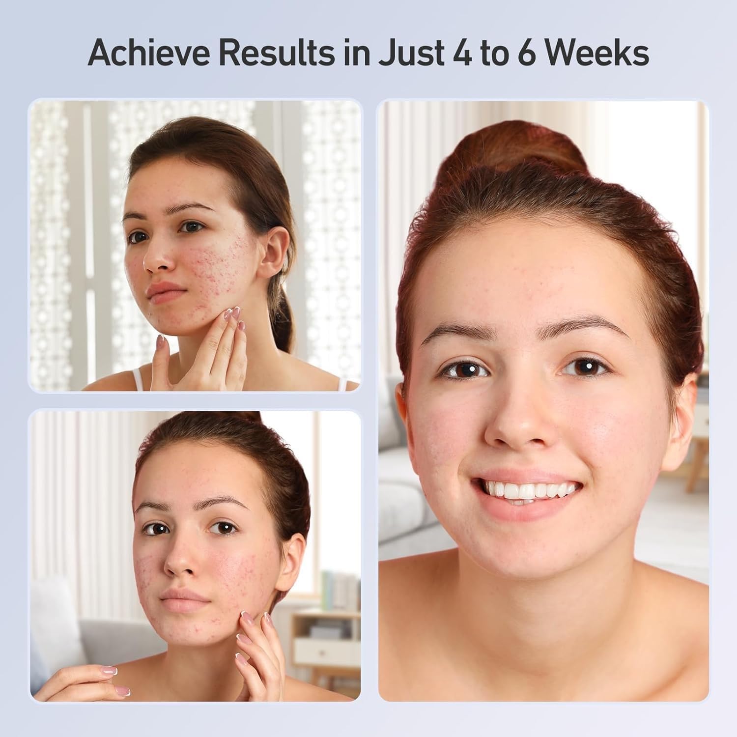 Acne Removal Facial Mask – Thoughtful design