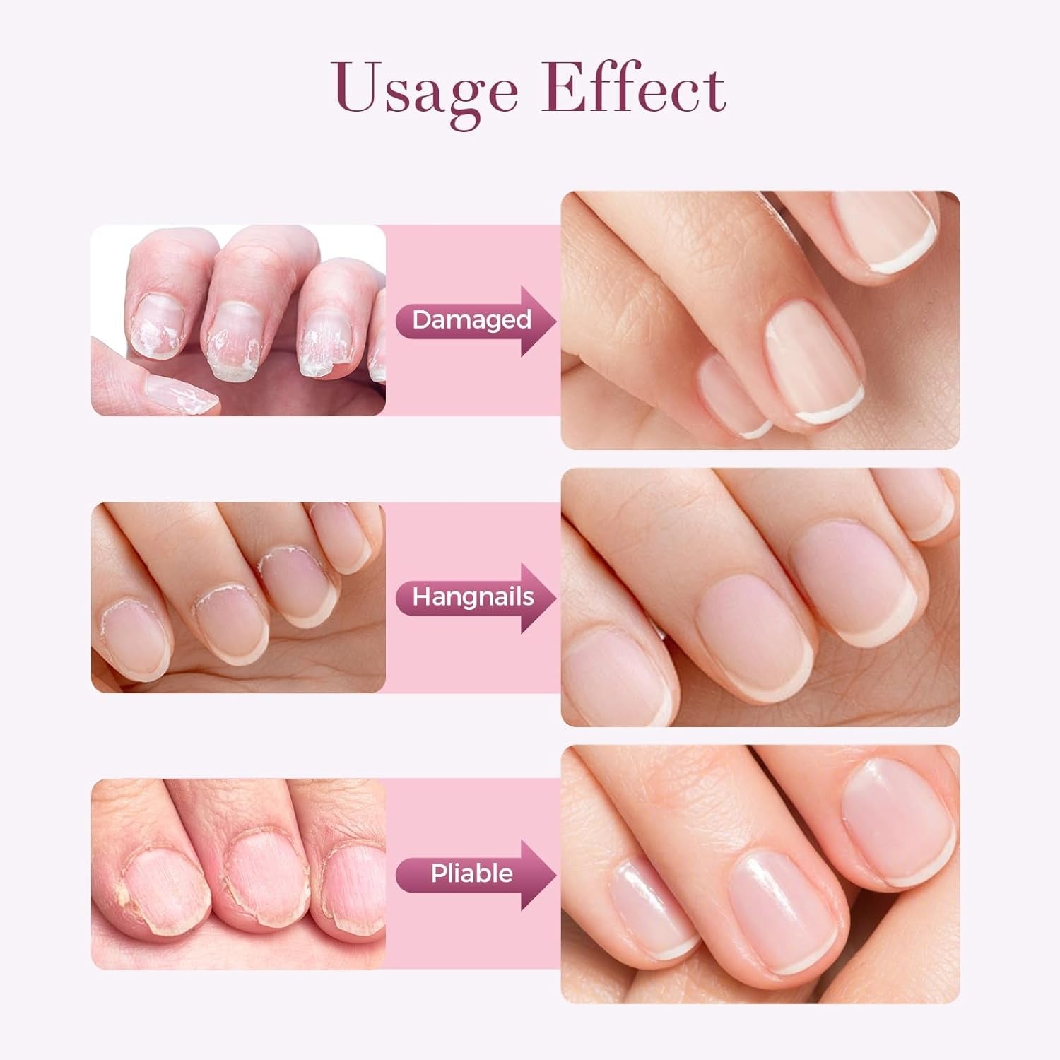 Nail Care Pen – Strengthens & Protects Nails